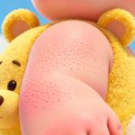 寶寶皮膚像鷄皮疙瘩